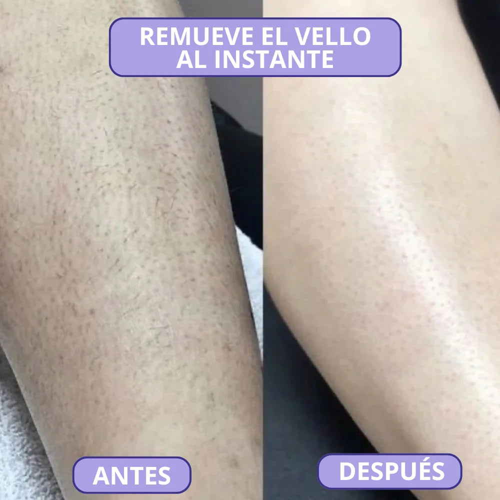 Bleame - Depilación Instantánea Sin Dolor