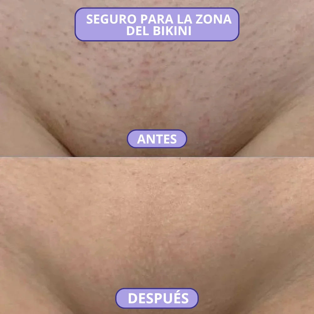 Bleame - Depilación Instantánea Sin Dolor