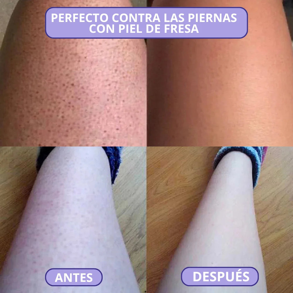 Bleame - Depilación Instantánea Sin Dolor